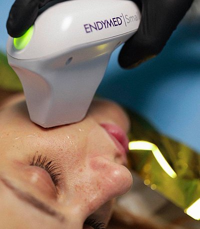 I trattamenti INVASIVI