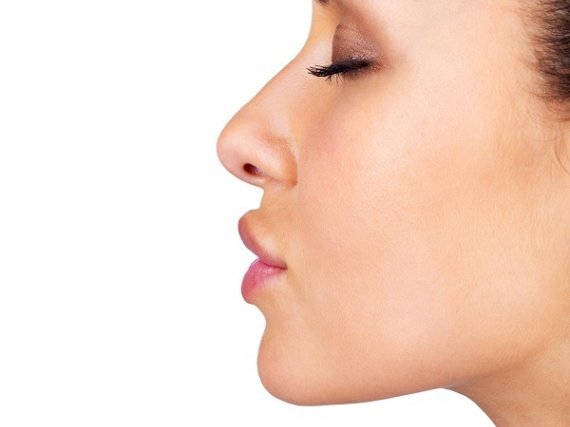 Rinoplastica