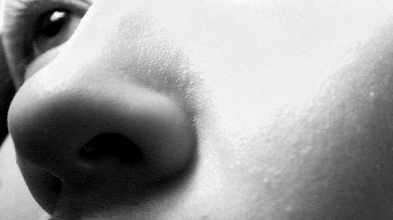 When cosmetic surgery is ethnic ❒ Studio Romano Fuhr